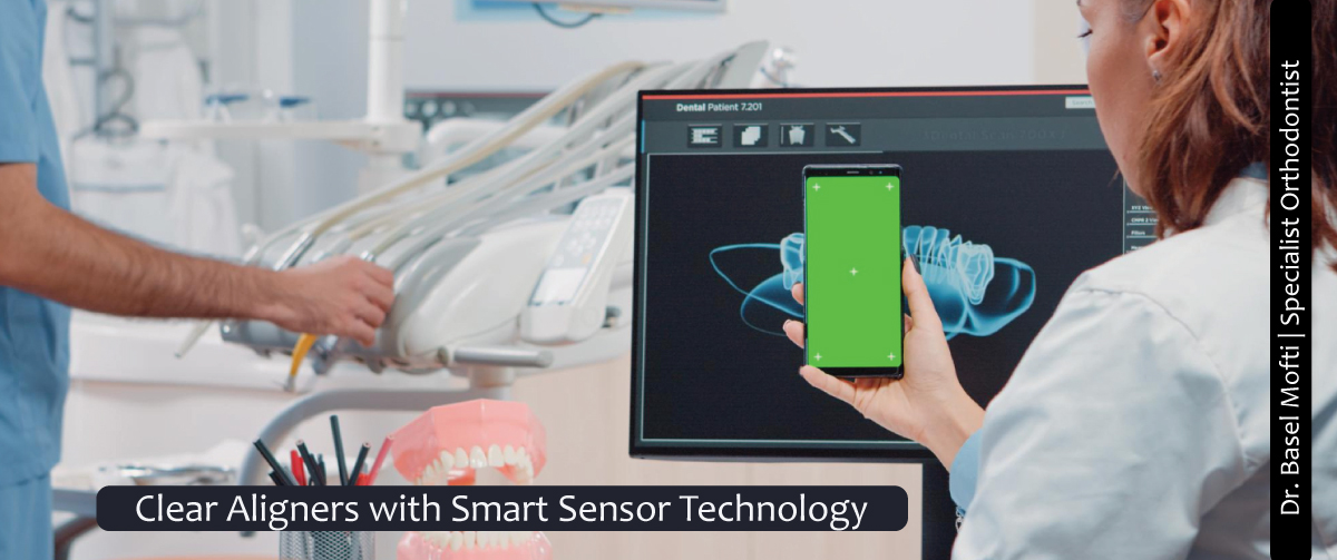 Smartee Innovations Revolutionizing Orthodontics with Cutting-Edge Technology